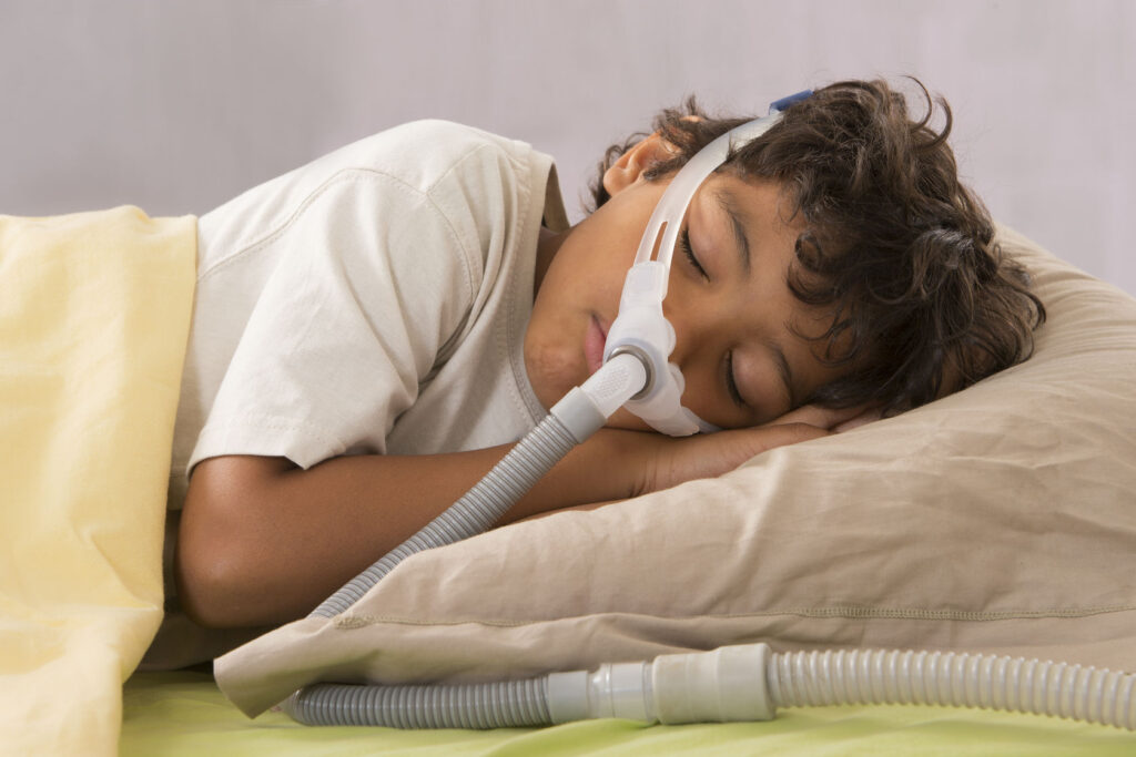 Essential Questions to Ask a CPAP Machine Supplier to Buy the Right Mask for Your Child